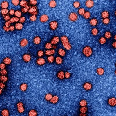 egypt first in africa to eliminate hepatitis b