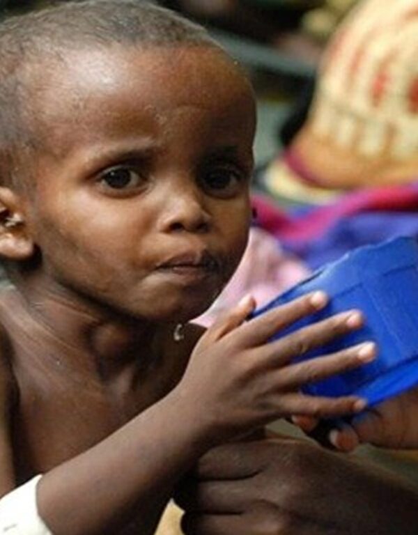 Somalia’s Child Hunger Crisis