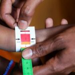 Somalia child malnutrition